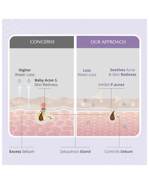 AREOVEDA AreoVeda Moisturising Baby Spray Lotion - Soothes Baby Acne Lab Tested, Ecocert Certified, EWG Verified - 200 ml